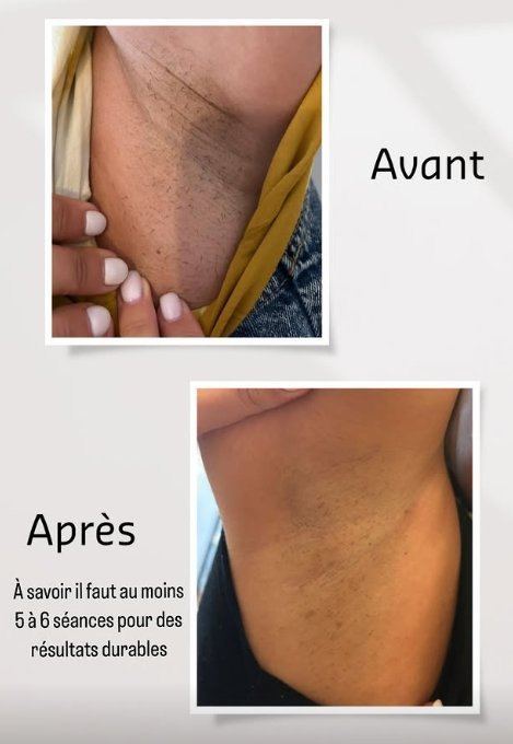 Comparatif jambes laser