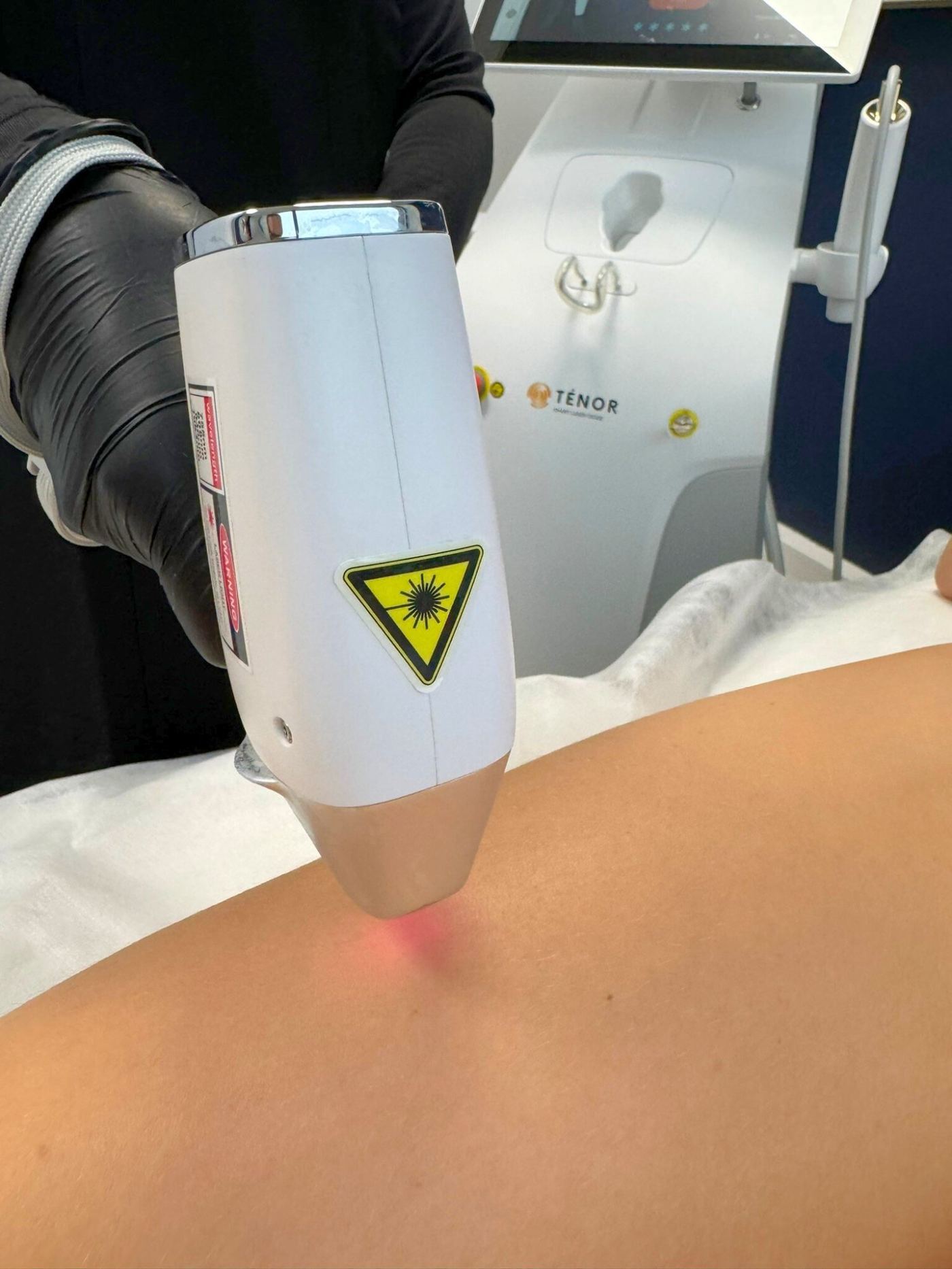 Épilation laser aisselles Salon 89